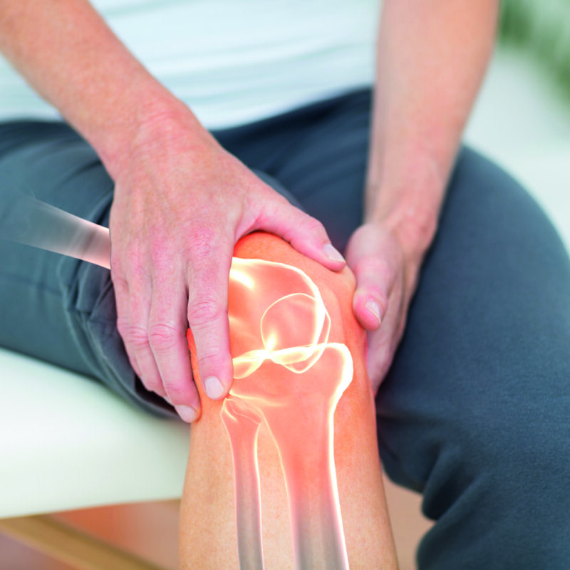 Knie